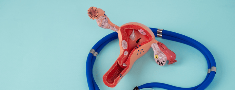 ¿Cómo abortar legalmente en México? Conoce los requisitos y el proceso para acceder a un aborto legal y seguro.