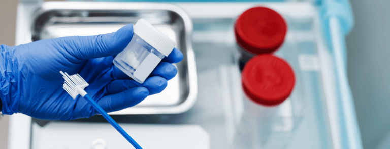 La prueba de Papanicolaou: vital para prevenir el cáncer cervical y proteger la salud reproductiva.